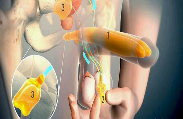 Lipofilling