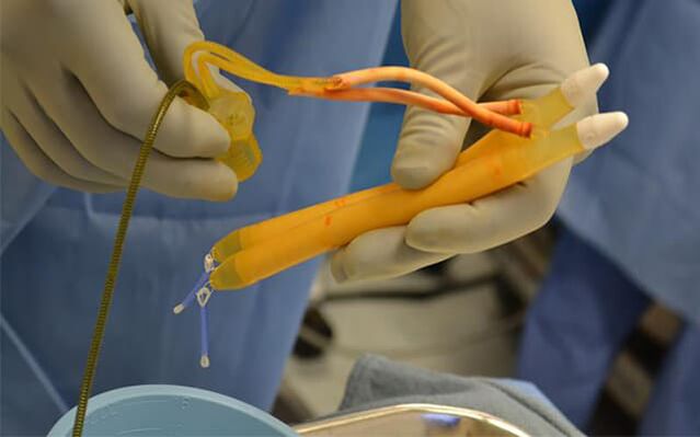implantat i penis